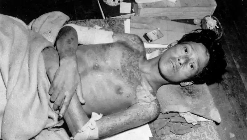80 Yıl Sonra Nagasaki'den Gelen Uyarı: Nükleer Felaket Cervası